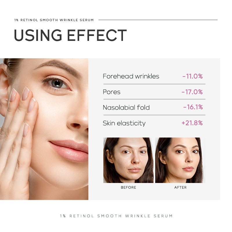 Sérum lissant anti-rides Quiyu - The Ordinary Serum Hyaluronic Acid avis et prix